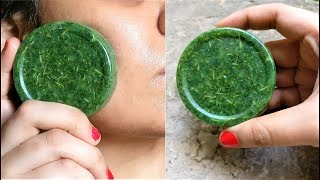 Homemade Neem Soap to remove FULL Body ACNE amp PIMPLES Full Body Polishing Soap with Vitamin E Oil [upl. by Michi]