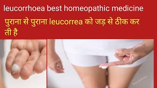 Leucorrhoea homeopathy treatmentLeucorrhoea homeopathy treatmentleucorrhoea Homeopathic medicine [upl. by Ahterahs363]