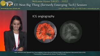 NearInfrared Laser Speckle DyeFree Imaging in Swine Bowel Ischemia Model Could Replace Indocya [upl. by Idieh]