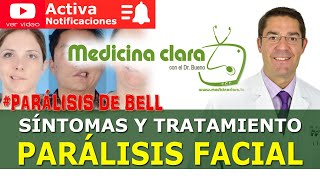 Parálisis facial periférica Parálisis de Bell Bell´s Palsy ¿Qué es exactamente  Medicina Clara [upl. by Ahsikcin]