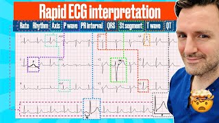 How to Read an EKG  ECG Reading Beginners Guide [upl. by Malamud]