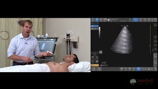 Point of Care Lung Ultrasound POCUS [upl. by Connel172]