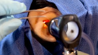 ASMR Removing a Foreign Object from Your Ear  Doctor amp Patient POV  Hearing Test [upl. by Eilla]