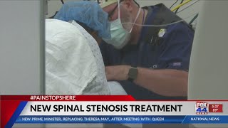 There is a new treatment for Spinal Stenosis [upl. by Lomax]