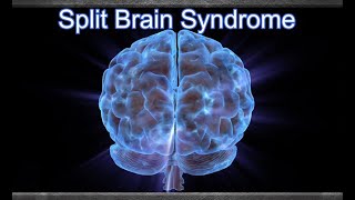 Split Brain Syndrome or Callosal Disconnect Syndrome  Definition Features Effects and Significanc [upl. by Kcirb]