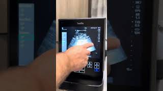 Sonosite s2 bladder scanner function [upl. by Radnaxela]