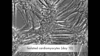 Enriched Cardiomyocytes  Beating from Day 1 [upl. by Strawn]