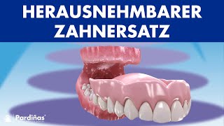 Herausnehmbarer ZAHNERSATZ  Reinigung und Pflege von VOLLPROTHESEN © [upl. by Carrol796]