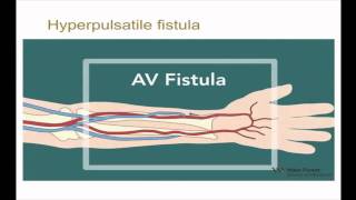 10minute Rounds Outflow Stenosis and the Arteriovenous Fistula [upl. by Sim]