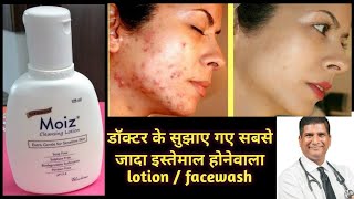 Moiz cleansing lotion  moiz cleanser for sensitive skin  best facewash acne pimples dryskin [upl. by Ornstead]