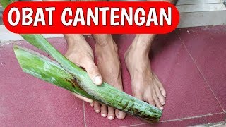 Cara mengobati Cantengan di kaki [upl. by Slack]