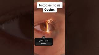 Toxoplasmosis ocular congénita [upl. by Antonina330]