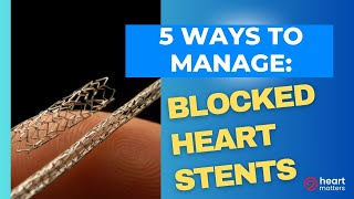 5 ways to manage blocked heart stents [upl. by Beck]