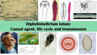 Diphyllobothrium latum Causal agent life cycle and transmission [upl. by Yesac]