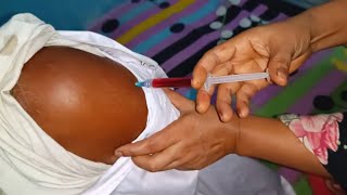 Arm Injection Push Vitamin B1B6B12 injection video Nugesic 24 Ep 32 By Injection Media [upl. by Pam960]