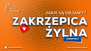 ZAKRZEPICA ŻYLNA  jakie są jej objawy [upl. by Airelav]