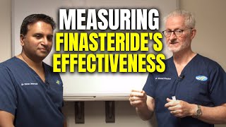 Measuring Outcomes of Finasteride [upl. by Adnahsal]