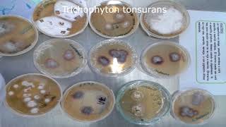 Dermatofitosis  Trichophyton spp  Cultivo  Pura Ciencia [upl. by Nerual]