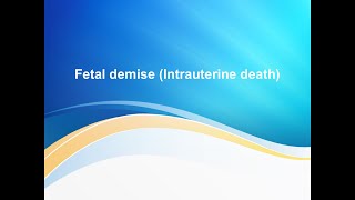 Fetal demise  Intrauterine death [upl. by Noedig474]