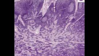 Shotgun Histology Lymph Node [upl. by Clymer693]