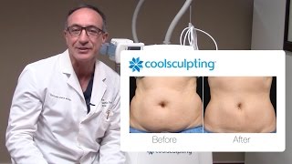 CoolSculpting Procedure Before and After with Dr Lista  The Plastic Surgery Clinic [upl. by Bail215]