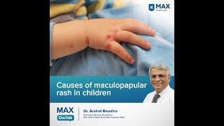 Causes of maculopapular rash in children  Dr Arvind Bountra  Max Hospital Saket [upl. by Ecinuahs]