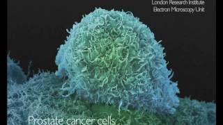 What Does Cancer Look Like  Cancer Research UK [upl. by Oswin915]