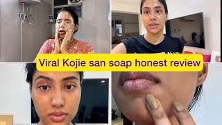 Skin lightening soap  Kojie san soap most honest review Yashi Tank [upl. by Ihsoyim]