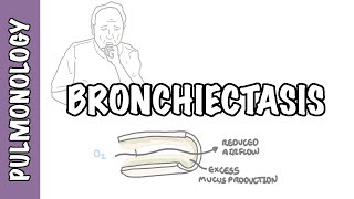 Bronchiectasis  causes pathophysiology signs and symptoms investigations and treatment [upl. by Eniamaj]