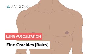 Fine Crackles Rales  Lung Auscultation  Episode 2 [upl. by Imugem]