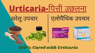 Urticariaपित्ती उछलना Allopathic treatments amp Home Remedies in Hindi II शीतपित्त का 100 इलाज I [upl. by Naihtsirc]