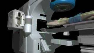 Community Cancer Institute  TrueBeam Linear Accelerator [upl. by Tiduj29]