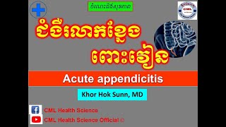 ជំងឺរលាកខ្នែង ពោះវៀន ll Acute appendicitis symptoms and prevention l cmlhealthscienceofficial [upl. by Oliviero142]