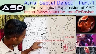 Atrial Septal Defects – Embryology  Lecturio [upl. by Saddler]