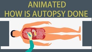 Autopsy Detailed animation on how is Autopsy done [upl. by Thackeray]