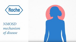 Neuromyelitis optica spectrum disorder  Mechanism of disease [upl. by Nohsed]