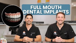 Full Mouth Dental Implants Everything You Need to Know and Cost [upl. by Llegna]