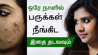 How to remove pimple  Home remedies for pimples  Beauty Tips in Tamil [upl. by Hilarius]