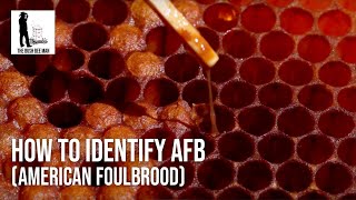 How to Identify AFB American Foulbrood  The Bush Bee Man [upl. by Anoek]