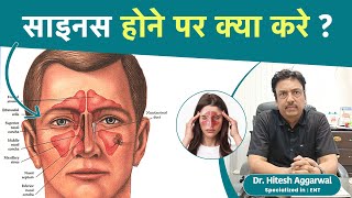 Sinus होने पर क्या करें  How to avoid sinus  Doctor brief  nose  eye  dr Brief [upl. by Eedahs]