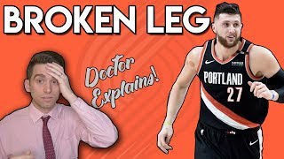 Jusuf Nurkic SCARY BROKEN LEG  Doctor Explains Injury [upl. by Nielson]