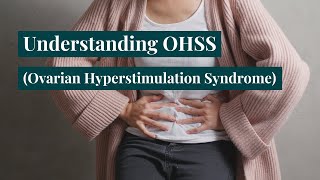 Ovarian Hyperstimulation Syndrome  OHSS Symptoms Treatment and Fertility [upl. by Bradney257]