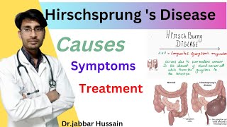 Hirschsprung Disease in hindi [upl. by Eiluj172]