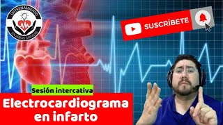 Reto de Electrocardiograma en infarto Estas listo By Dr Zamarrón [upl. by Georges]