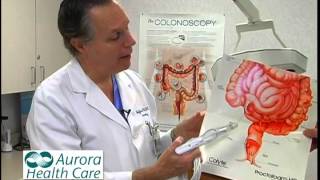 HET Hemorrhoid Treatment [upl. by Annail]