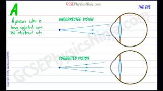 Long Sighted Vision Correction  Physics of Light [upl. by Dede]