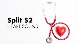 Fixed Split S2  Heart Sounds  MEDZCOOL [upl. by Holcomb]