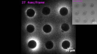 Flash of light that sparks when a sperm meets an egg [upl. by Aydan]