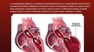 Patologie dellApparato Cardiovascolare [upl. by Dolloff853]