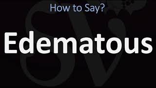 How to Pronounce Edematous CORRECTLY [upl. by Nimsay593]